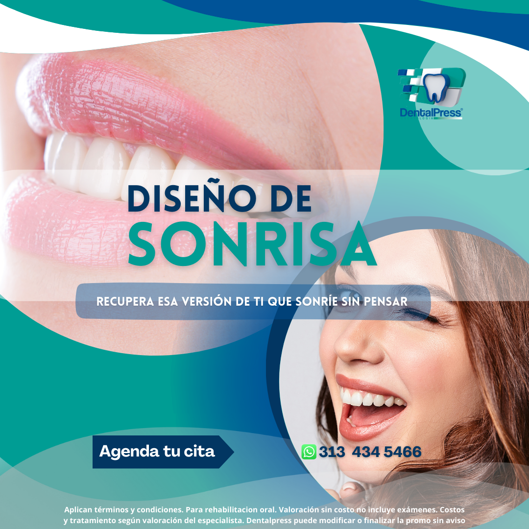 Diseño de Sonrisa (1)