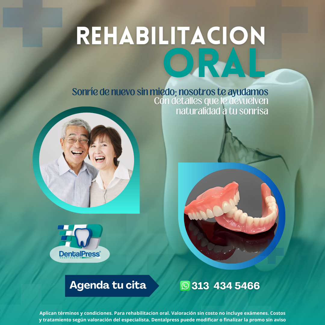 Rehabilitacion Oral